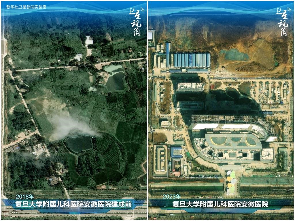 2023年與2018年相比，復(fù)旦大學(xué)附屬兒科醫(yī)院安徽醫(yī)院從一片荒地到建成投用。該項目是安徽省在長三角一體化高質(zhì)量發(fā)展衛(wèi)生健康領(lǐng)域的重大項目，也是安徽首批落地的國家區(qū)域醫(yī)療中心。
